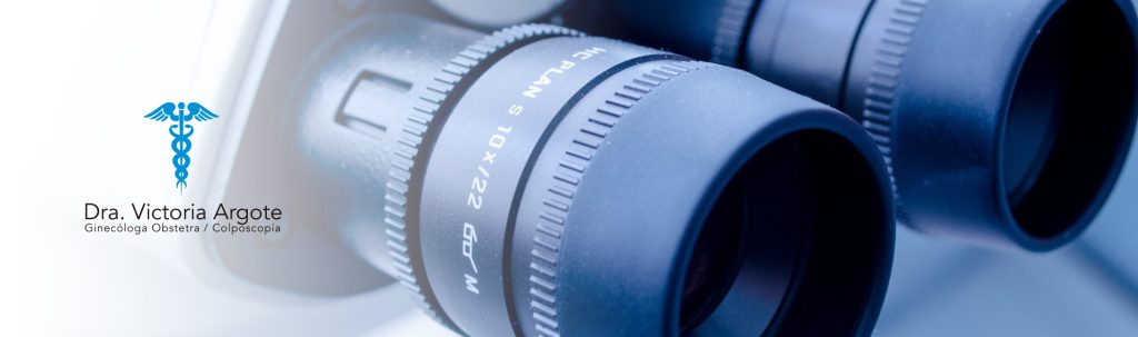 Colposcopia